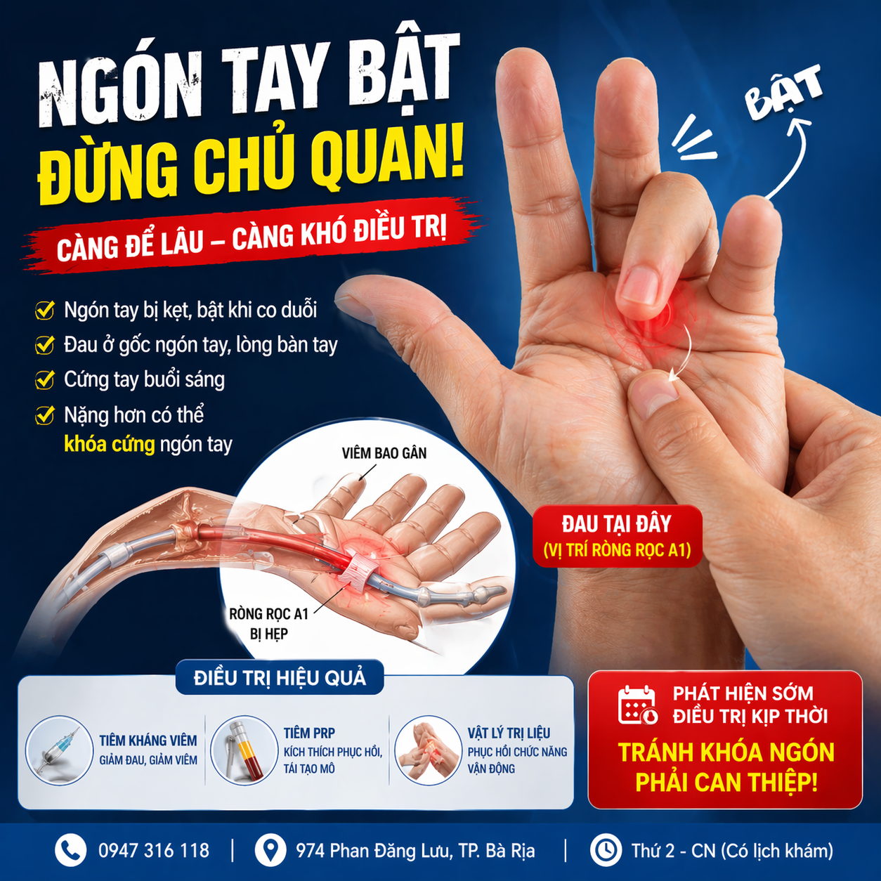 NGÓN TAY BẬT- BỆNH GÌ?